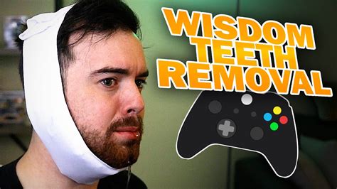 Can I Play Video Games After Wisdom Teeth Removal? A Detailed Analysis